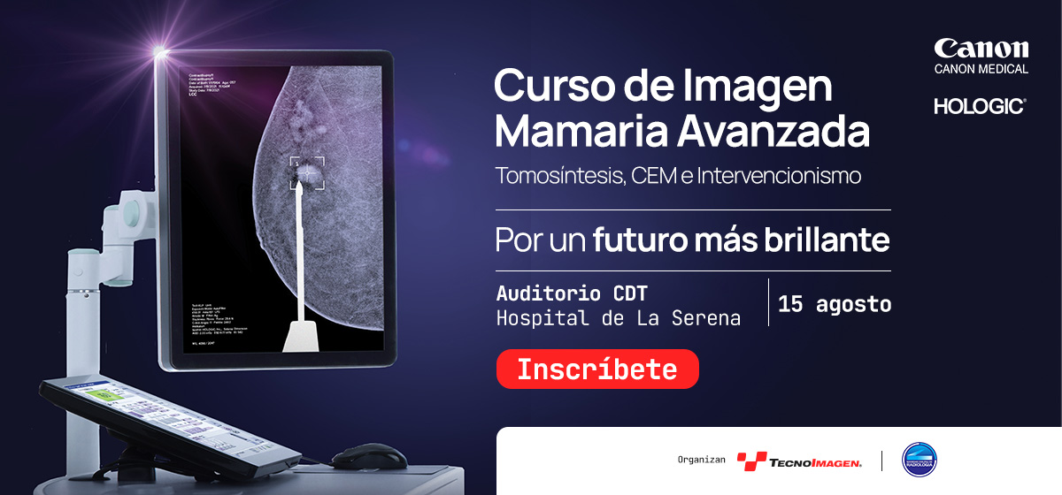 Curso de Imagen Mamaria Avanzada - Auditorio CDT, Hospital de La Serena, 15 de agosto. Inscríbete.